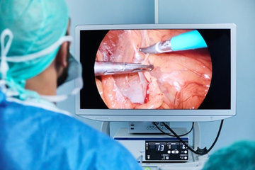 Doctor in Laparoscopic Surgery