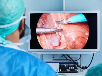 Doctor in Laparoscopic Surgery