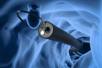 Endoscope that removes a polyp from the colon